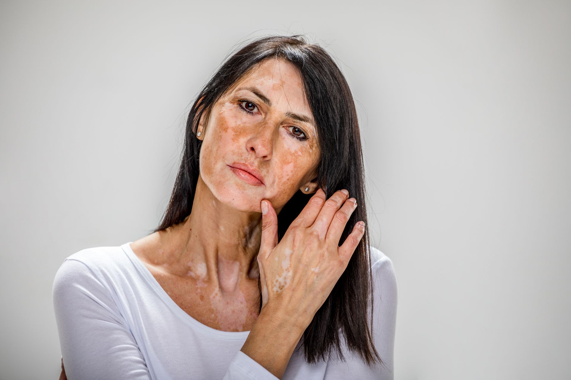 Natural Remedies for Skin Problems in Seniors: A Comprehensive Guide 